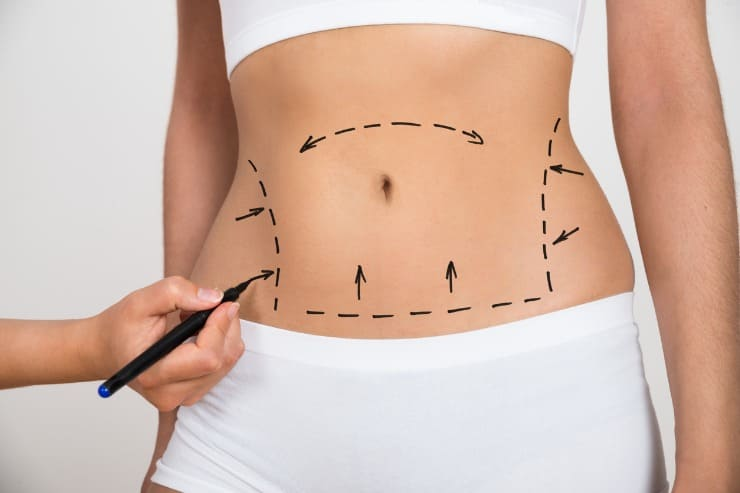 Cuidados Pré-Operatórios Essenciais para uma Cirurgia Plástica Segura