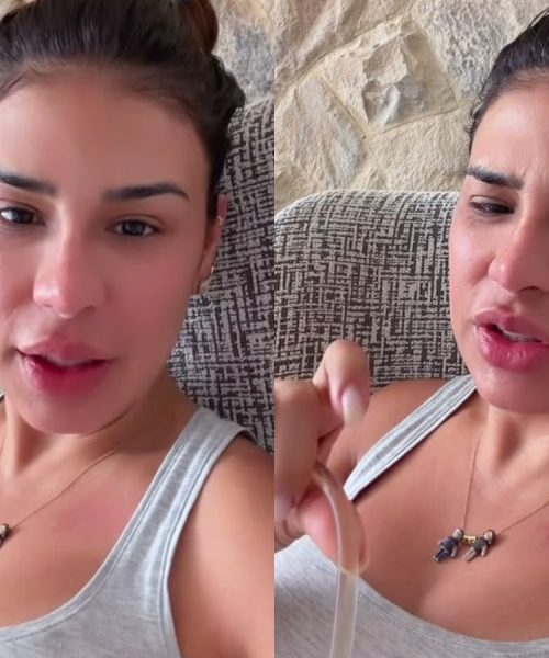 Simone Mendes revela progresso na recuperação pós-operatória e comenta sobre a remoção do dreno